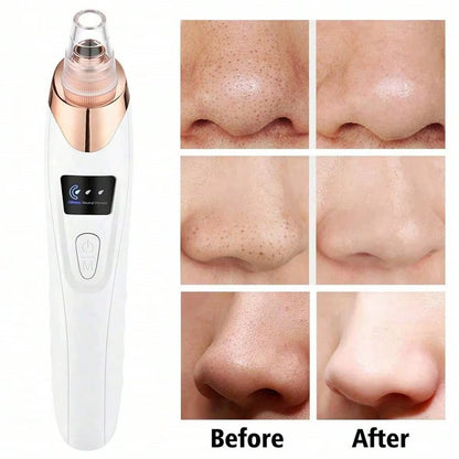 2026 Ultimate Facial Pore Cleaner - 5 Suction Levels Blackhead Remover & Rechargeable Vacuum Kit
