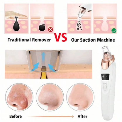 2026 Ultimate Facial Pore Cleaner - 5 Suction Levels Blackhead Remover & Rechargeable Vacuum Kit