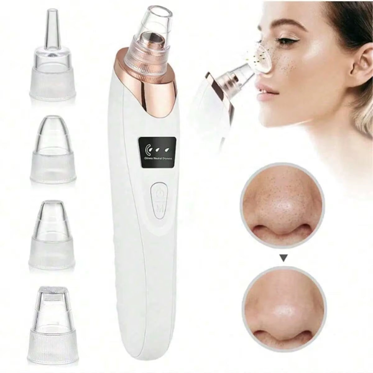 2026 Ultimate Facial Pore Cleaner - 5 Suction Levels Blackhead Remover & Rechargeable Vacuum Kit
